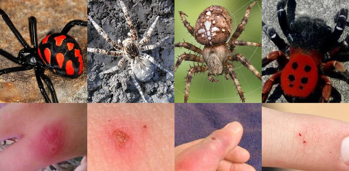 Poisonous spiders and their bites
